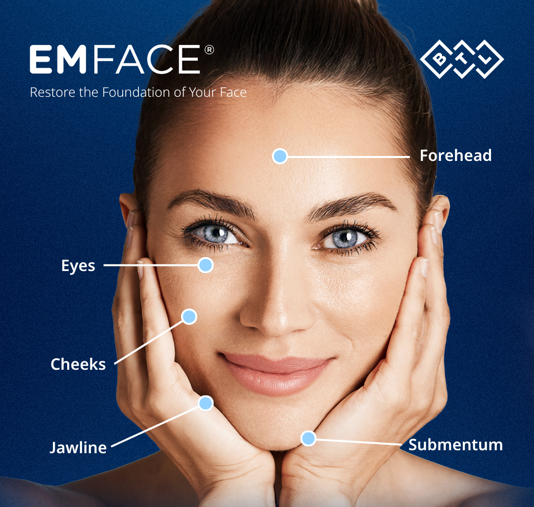 EMFACE facial treatment areas: forehead, eyes, cheeks, jawline and submentum